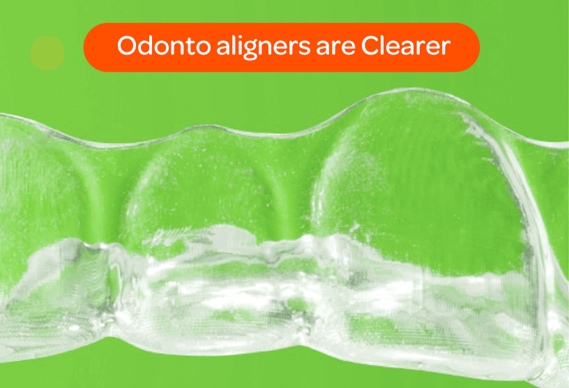 Odonto-clear-aligners