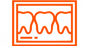 odonto-clear-aligner-scan