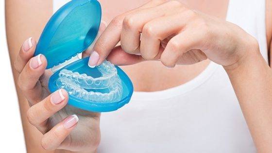 clear-aligners