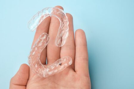 advantages of aligners