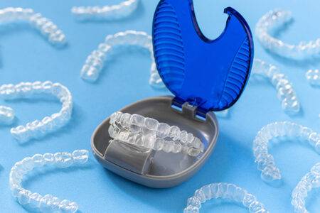 advantage of aligners