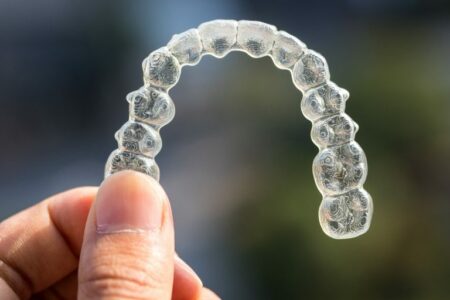 concerns about aligners