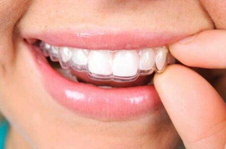 orthodontic care