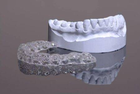 Digital Scanning of Clear Aligner