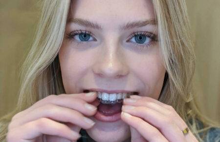 Orthodontic treatment