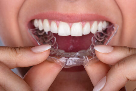 complex orthodontic cases