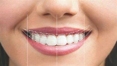 Digital Smile Design