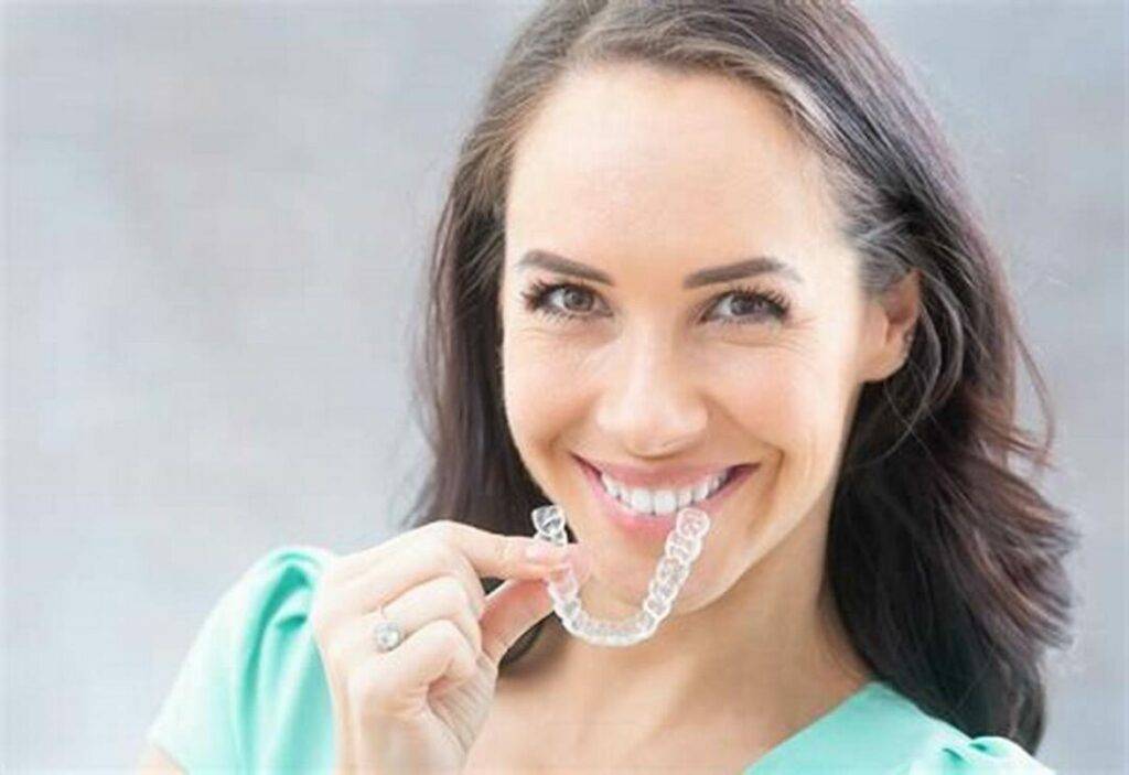 The Science Behind Clear Aligners
