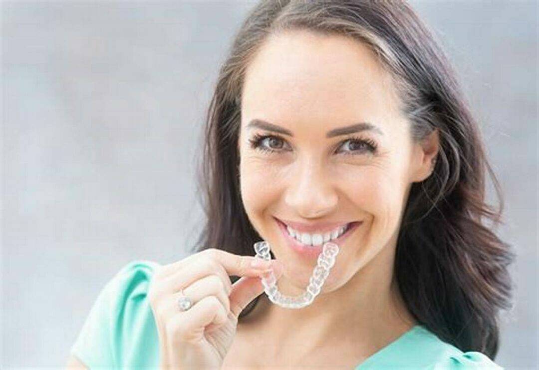 Aligners: The Science of Clear Orthodontics