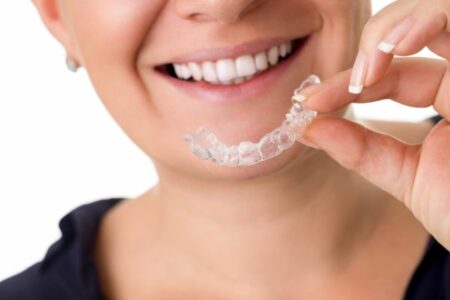 clear-aligners-1