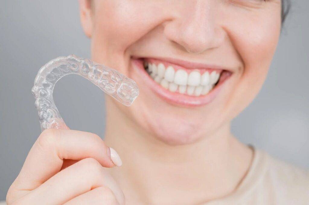 The Cultural Shift to Clear Aligners