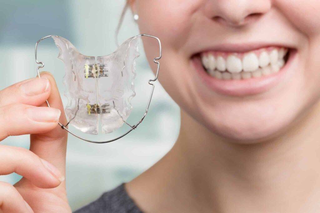 Orthodontic Retainers