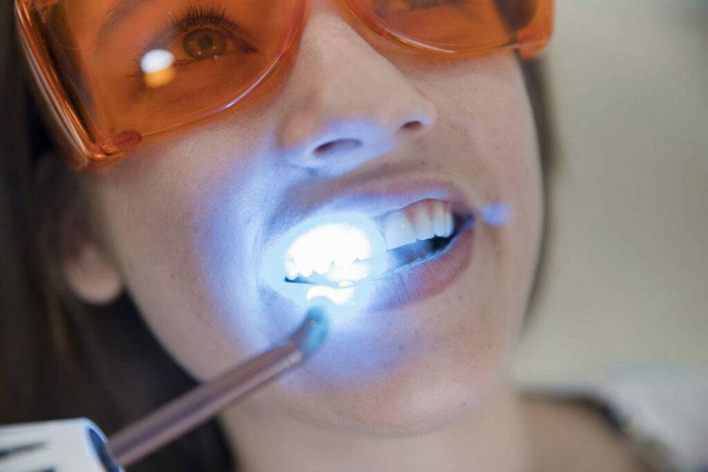 Laser Technology in Orthodontics