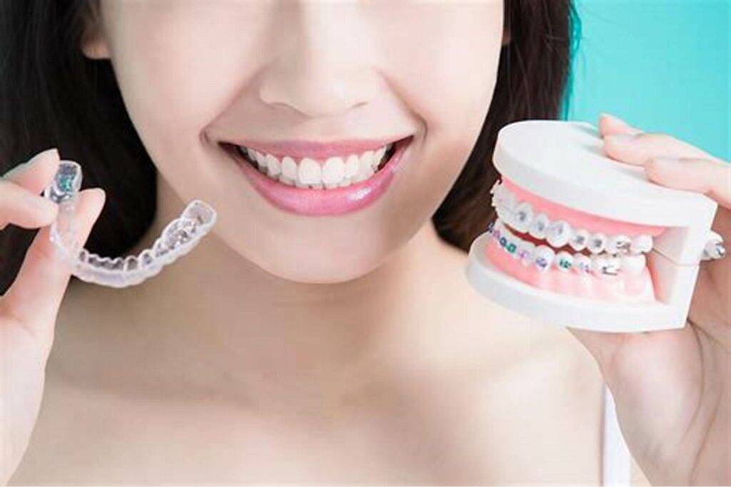 Clear Aligners vs. Traditional Braces