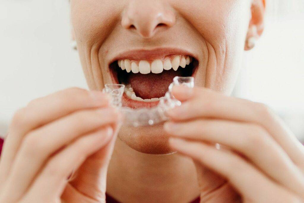 Clear Aligner Therapy