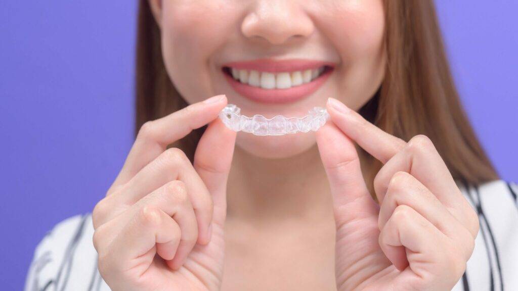 Clear Aligners Are Transforming Adult