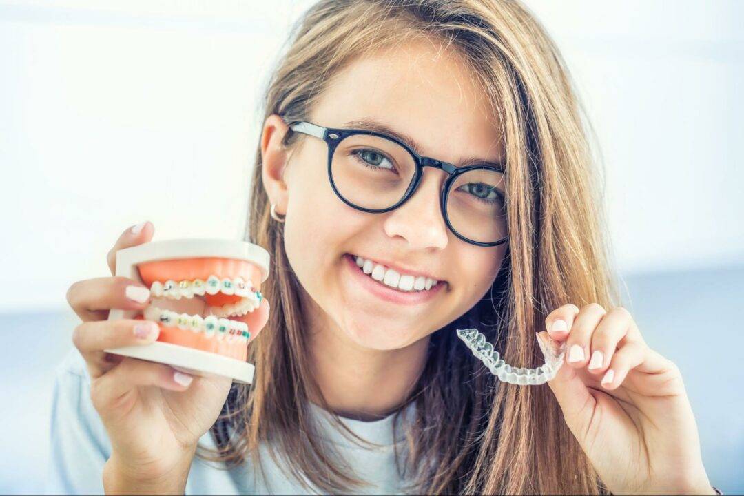 Clear Aligners for Teens