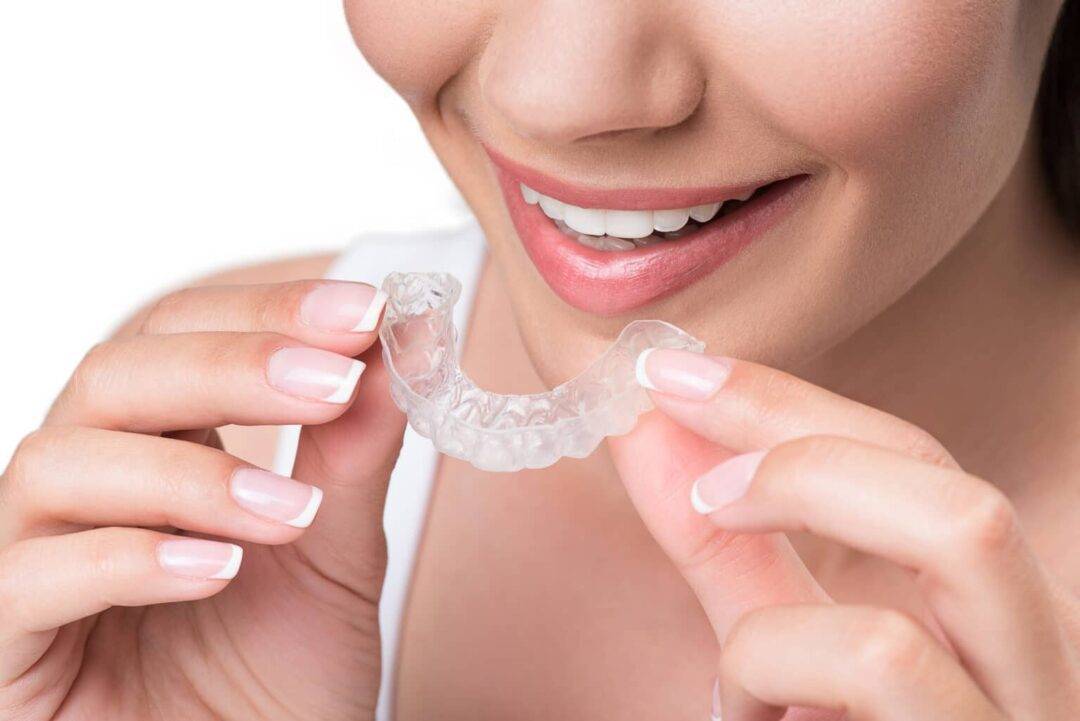 Clear Aligners: Educating Your Patients