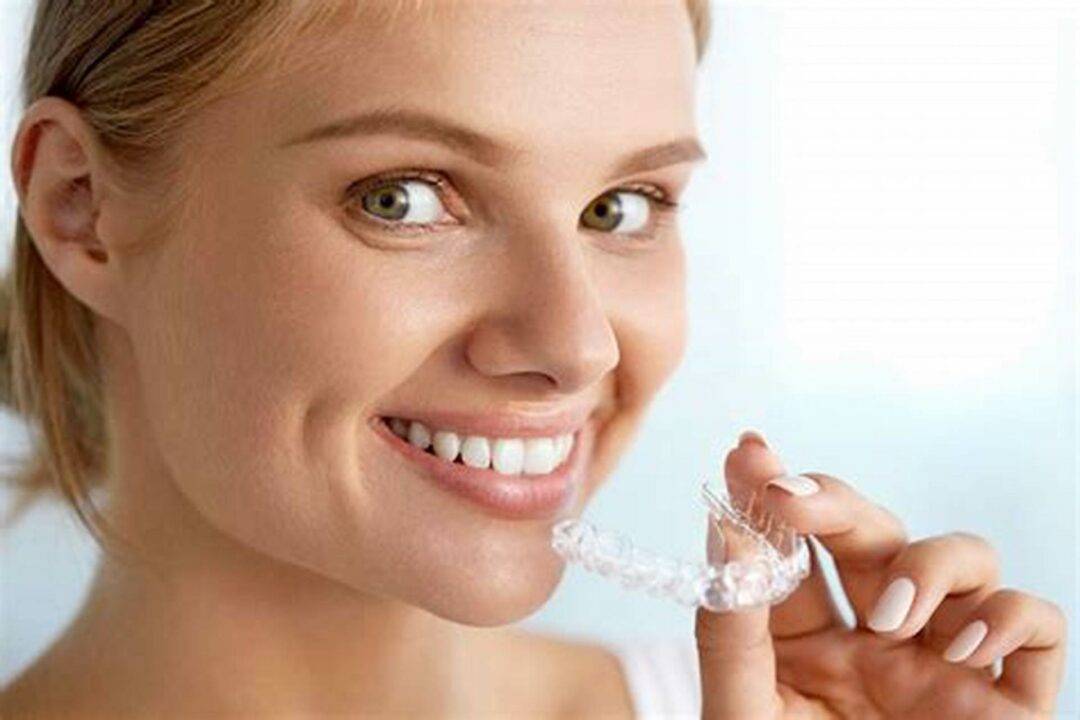 Clear Aligners for Post-Orthodontic Relapse