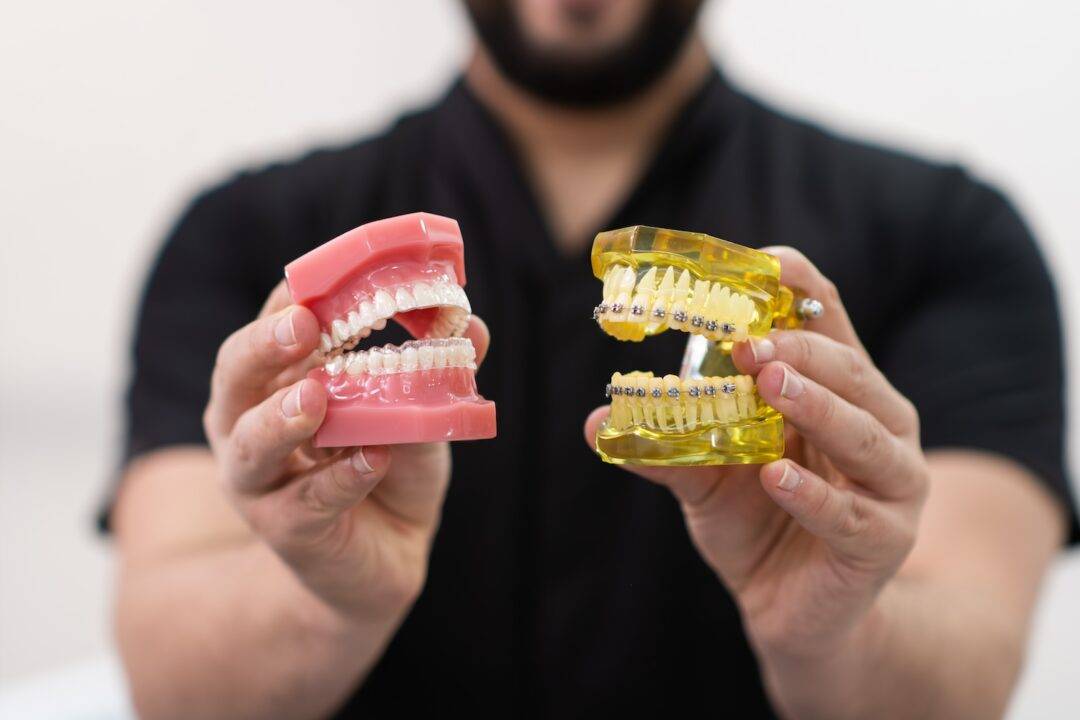 Clear Aligners vs. DIY Orthodontics