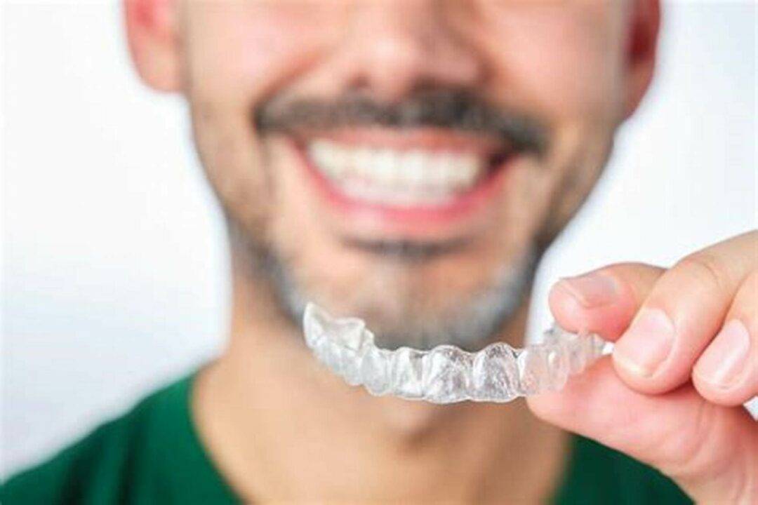 Smart Aligners