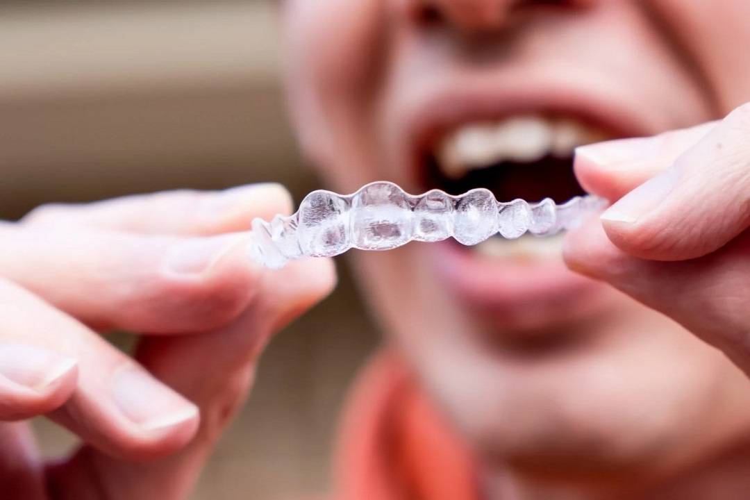 The Environmental Impact of Clear Aligners and Sustainable Alternatives