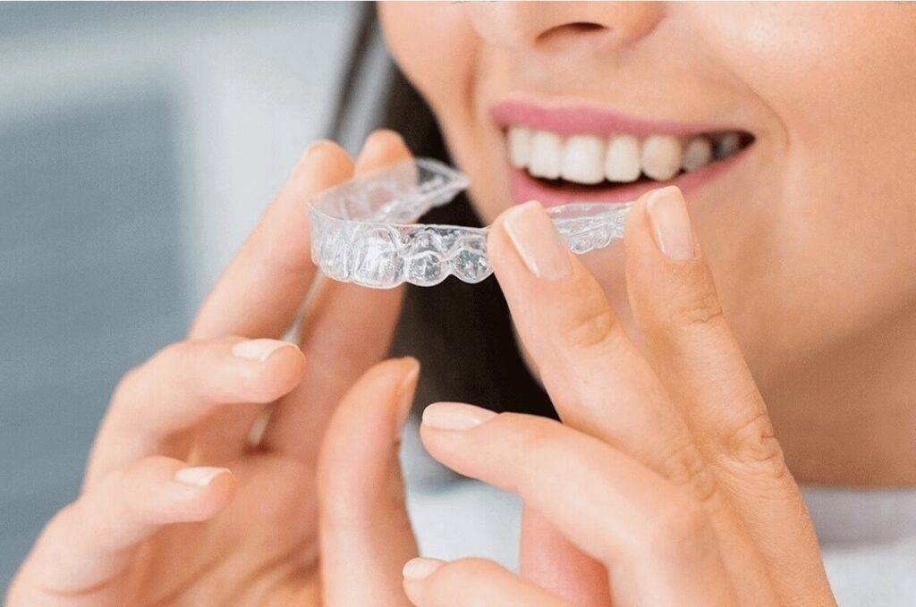 Future of Clear Aligners